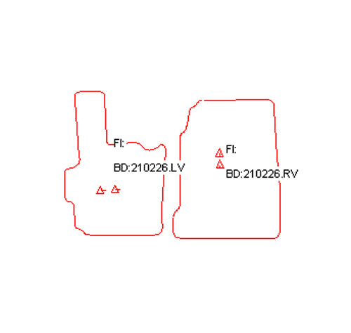 Automatten Daf CF65/75/85 (1993-2002)