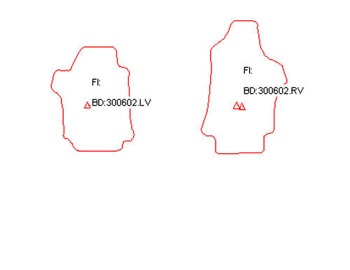 Automatten Hyundai H300 8-persoons (2007-Heden)