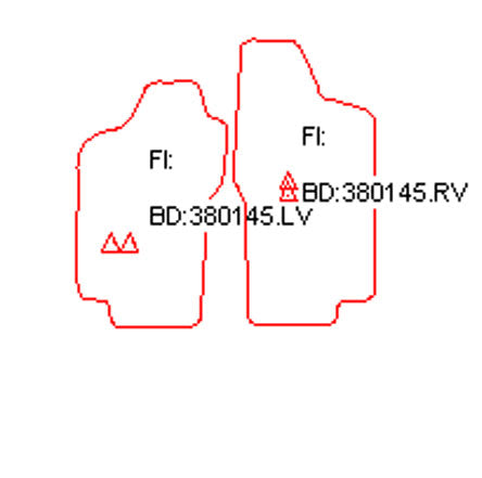 Automatten Lancia Delta / Delta HPE (1998-1996)