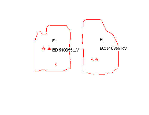 Automatten Mitsubishi Pajero Sport (2002-2008)