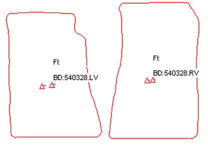 Automatten Opel Senator A (1978-1986)