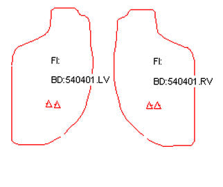 Automatten Opel Frontera B Sport (1998-2004)